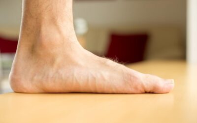 Don’t Ignore Flat Feet